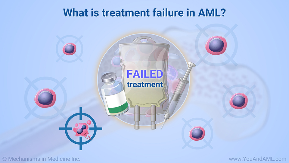 What is treatment failure in AML?