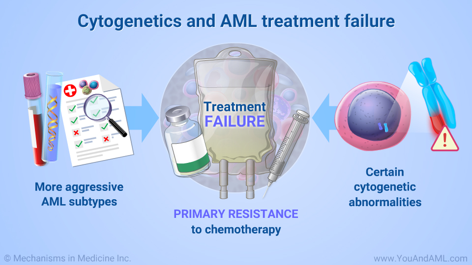 Cytogenetics and AML treatment failure