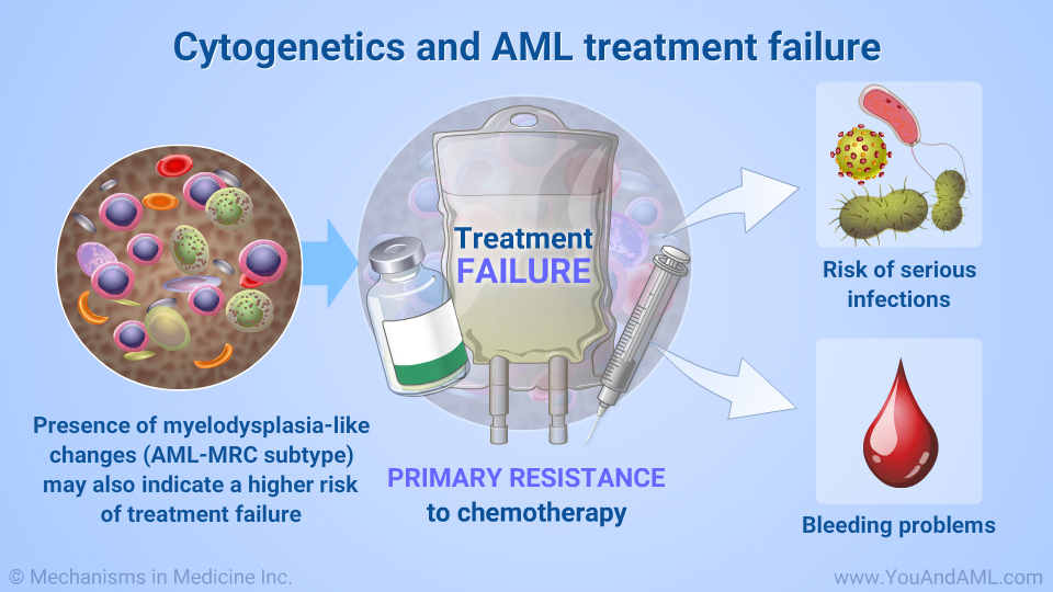 Cytogenetics and AML treatment failure