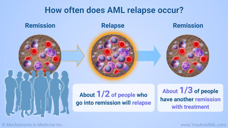 How often does AML relapse occur?