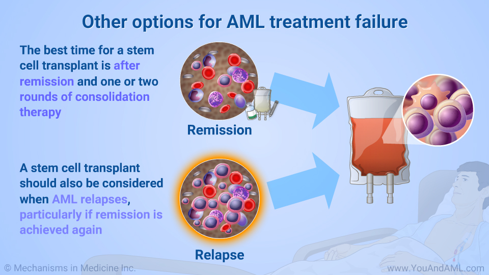 Other options for AML treatment failure