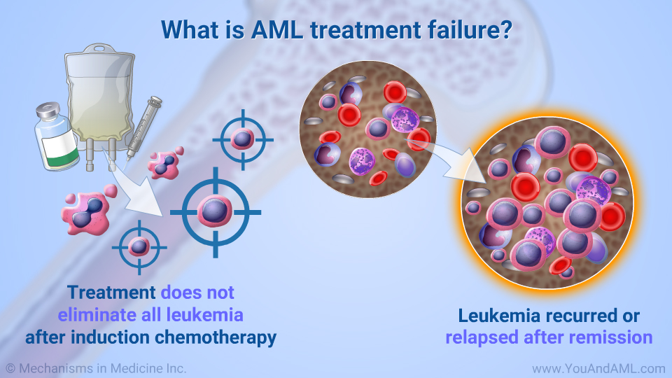 What is AML treatment failure?