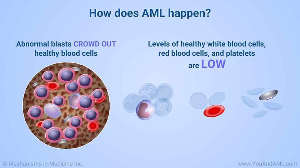 How does AML happen? (Continued)