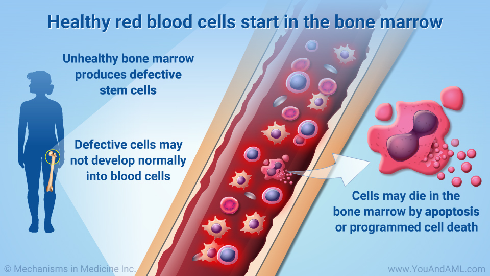 Healthy red blood cells start in the bone marrow